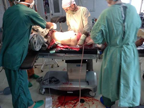 A je to za námi! Další úspěšná operace v traumacentru Lékařů bez hranic v Kundúzu.