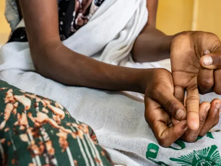 Kasanesh Ambaye (12), showing where the snake bit her