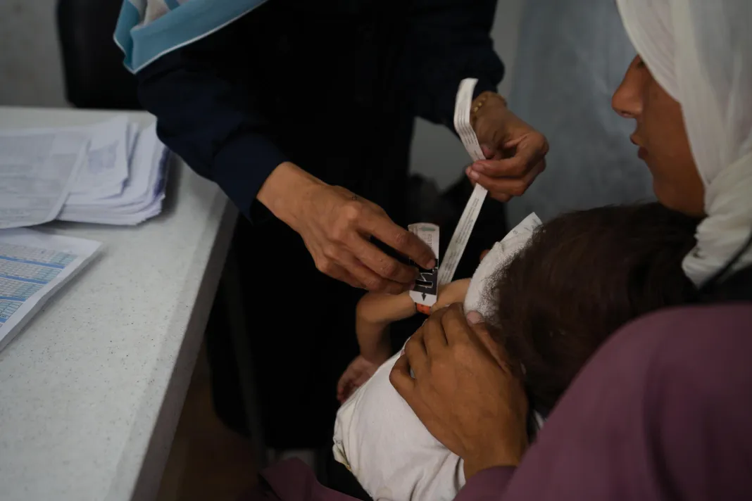 Měření podvýživy u dětí v Palestině. Pásmo Gazy, 2025. 
