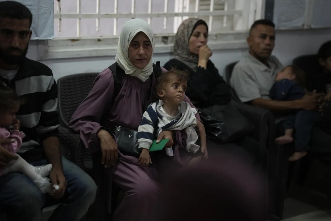 Palestinská matka a její roční syn Ahmed, u kterého byla diagnostikována podvýživa. Pásmo Gazy, 2025.