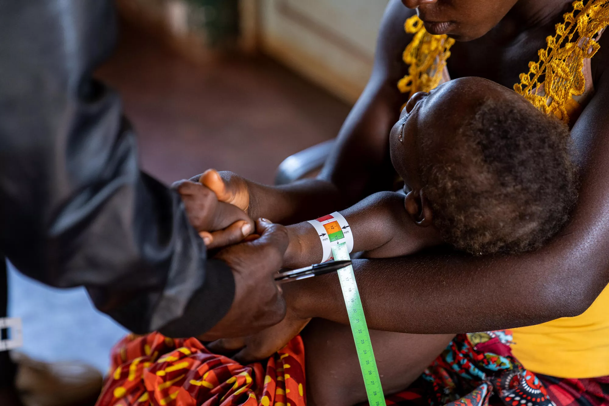 Helping tackle malnutrition and malaria in Angola