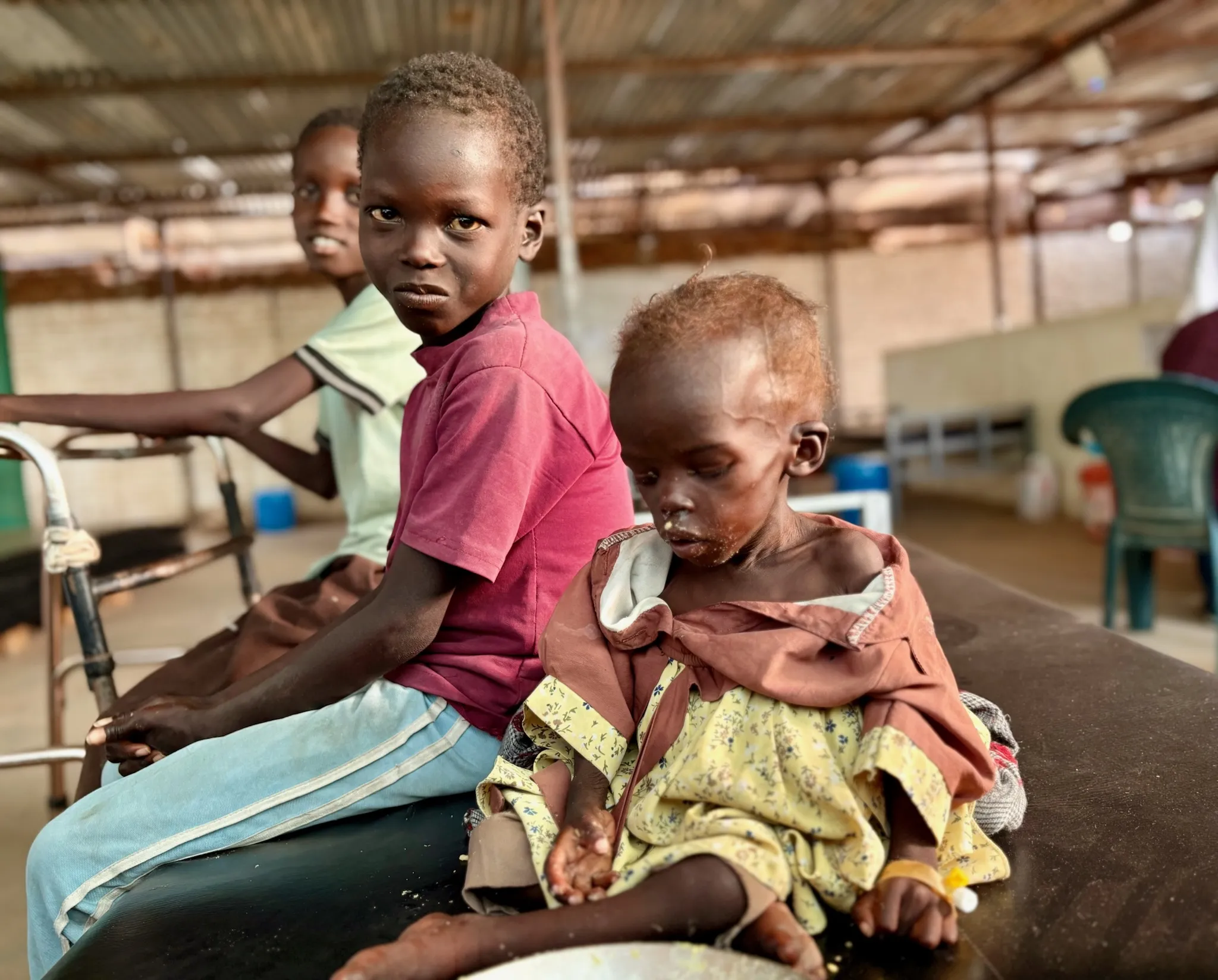 Dvouletá podvyživená holčička z Fáširu.